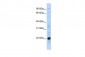 CRIP2 antibody - middle region